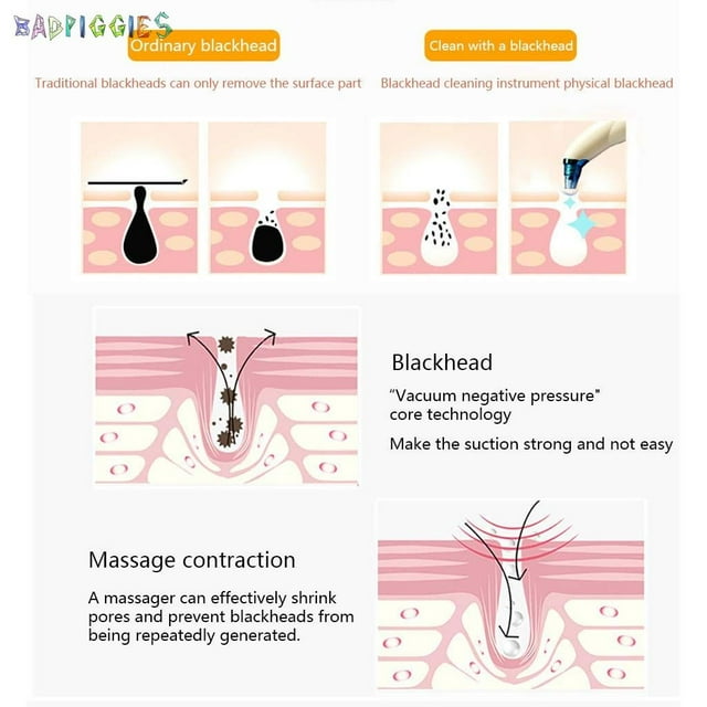 BadPiggies Electric Blackhead Vacuum Remover, Facial Pore Sucker Whitehead Blackhead Removal Cleansing Tool for Men and Women, White