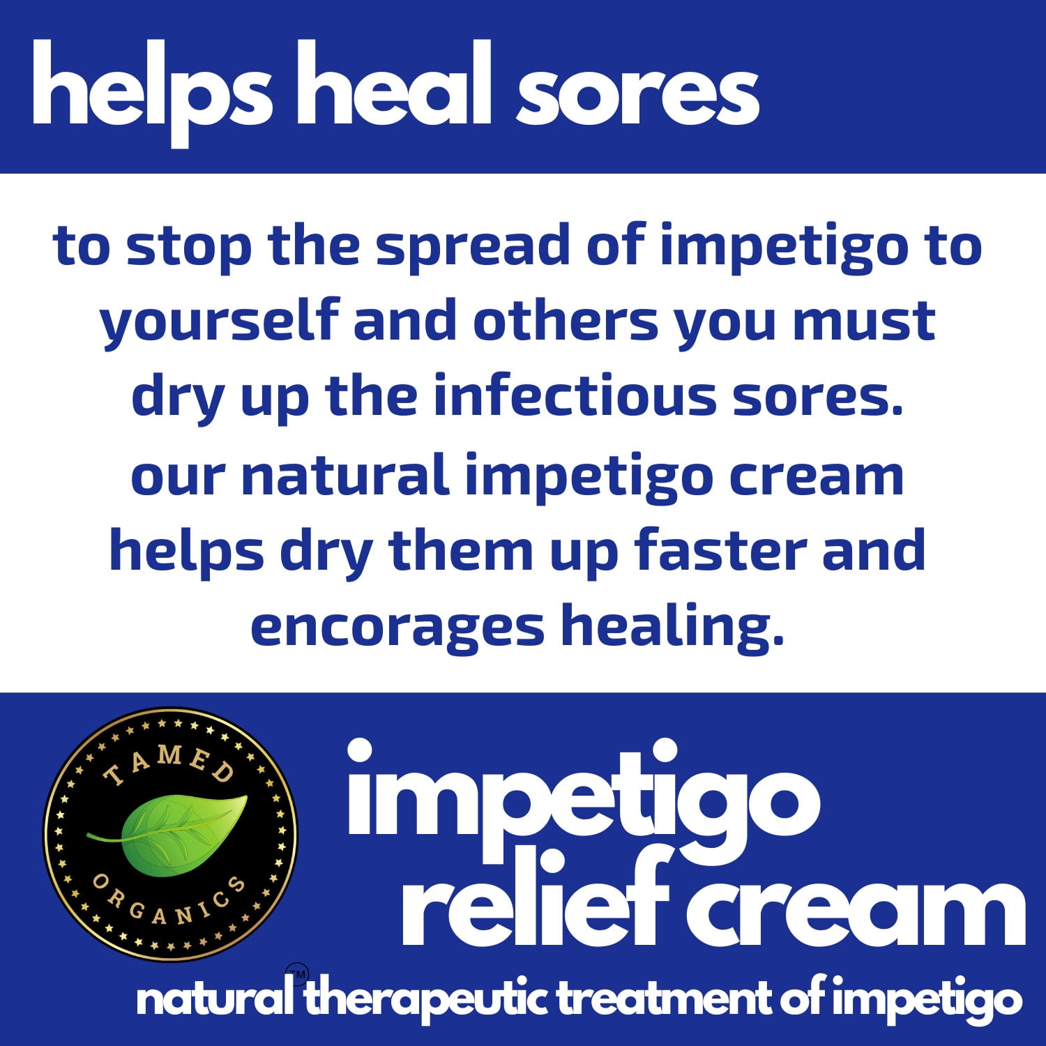 Impetigo Natural Topical Relief Treatment  Cream Over The Counter by Tamed Organics Brand