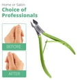 thumbnail image 6 of Green Estetica-Professional Cuticle Trimmer Nail Cuticle Cutter Stainless Steel Cuticle Nippers with Sharp Blades of Cuticle Clippers (Green), 6 of 8
