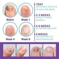 thumbnail image 5 of 2pcs Medinail Nail Fungus Spray Toenail Fungus Treatment, Nail Fungus Treatment For Toenail Gray Nail Repair Spray, 5 of 5