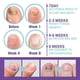thumbnail image 5 of 2pcs Medinail Nail Fungus Spray Toenail Fungus Treatment, Nail Fungus Treatment For Toenail Gray Nail Repair Spray, 5 of 5