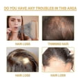 thumbnail image 2 of EELHOE Rice Anti-Hair shampoo deep clean, moisturize and repair hair roots, strengthen hair and preve, 2 of 4