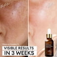 thumbnail image 3 of Sérum para el cuidado de la piel Inblair Rejuvenate Rejuvenate Rejuvenating Face 4x30 ml, 3 of 7