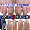 thumbnail image 5 of Tratamiento de uñas para el cuidado de los pies, esencia blanqueadora para los pies, Gel antiinfección para eliminación de hongos en las uñas de los pies, 5 of 5