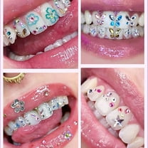 DIY Tooth Gem Kit with Multiple Design Inlays for Beauty Enhancement