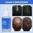thumbnail image 4 of Unlabeled Blue Copper Peptide Hair Essence 30ml - Promotes Hair Growth, Strengthens Roots, 4 of 8