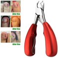 thumbnail image 2 of shiyou-Toenail Clippers for Thick or Ingrown Toenails - Precision Straight Edge Long Handle Toe Nail Clippers Scissors for Seniors Professional Trimmer (Red), 2 of 4