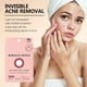 thumbnail image 4 of Facial Acne Patch Hydrocolloid Acne Patch With Tea Oil Witch Hazel Centella Asiatica And Hyaluronic (96 Tablets), 4 of 5