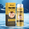 thumbnail image 1 of Etiqueta de remover spray de piel lisa Voluntad y etiquetas de eliminación de la crema de tratamiento de la crema suave y rápida Réguee Spray adecuado para hombres y mujeres, 1 of 9