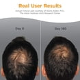 thumbnail image 3 of Suplementos para el crecimiento del cabello Viviscal Men 180 comprimidos durante 3 meses, 3 of 8