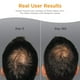 thumbnail image 3 of Suplementos para el crecimiento del cabello Viviscal Men 180 comprimidos durante 3 meses, 3 of 8