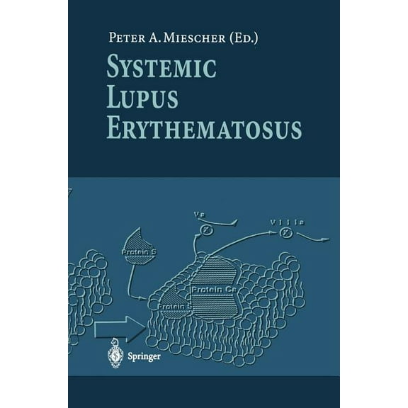 Systemic Lupus Erythematosus, (Paperback)