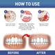 thumbnail image 4 of El gel dentífrico mejora la salud bucal y reduce la sensibilidad., 4 of 4