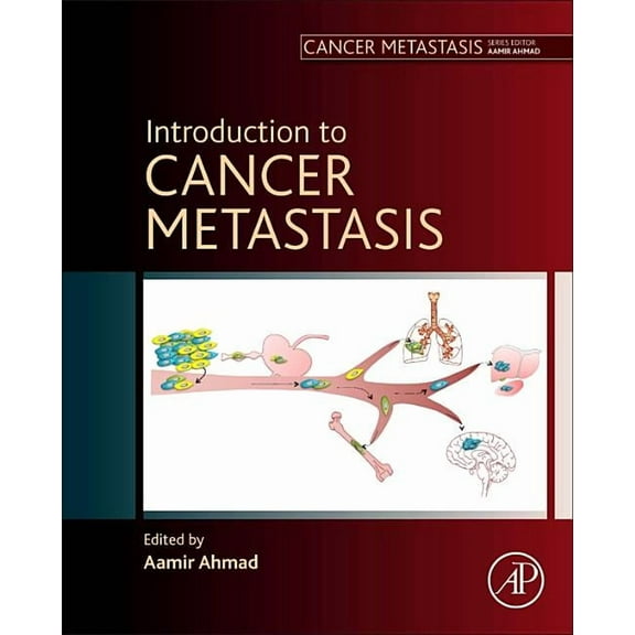 Cancer Metastasis Introduction to Cancer Metastasis, (Hardcover)