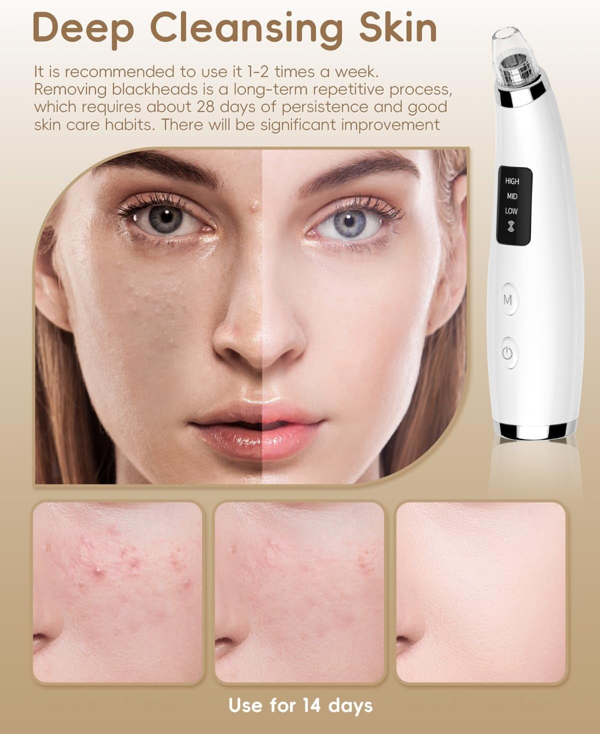 Facial Pore Blackhead Remover Vacuum - Face Cleaner and Blackhead Extractor with 3 Adjustable Suction Levels, 5Replaceable Tips - Pore Vacuum Kit for Women&Men (White)