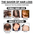 thumbnail image 4 of Ginger Hair Care Essential Oil Mild ingredients moisturize hair tail, smooth hair, ginger essence hair care oil, 4 of 5