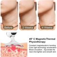 thumbnail image 5 of Anti-wrinkle Face Device, Face Massage Device, Skin Care Beauty Device, Toning Lifting For Face, 5 of 5