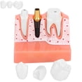 thumbnail image 3 of Modelo De Análisis De Implantes Dentales, Material De Resina Conveniente Demostración De Extracción Demostración Del Modelo De Diente Aprendizaje Del Estudiante Para, 3 of 7
