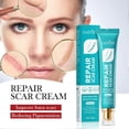thumbnail image 5 of Scars Repair Cream Effective Acnes Scars Removal Cream For Women Men, 5 of 5