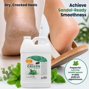 SPA REDI - Callus Remover for Feet Gel, Mint and Eucalyptus, 128 Oz - Professional Pedicure Foot Care - Removes Toughest Calluses in Seconds and Smooths Dry Cracked Heels