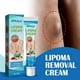 thumbnail image 2 of Eliminación de lipomas,Crema de eliminación de lipoma de 20 g Crema para disolver grasa,Ungüento de eliminación de bultos de grasa removedor de lipoma,Crema de eliminación de lipoma para Jinwen Eliminación de lipomas, 2 of 8