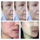 thumbnail image 4 of Sakura-crema facial antienvejecimiento, eliminador instantáneo de arrugas, líneas finas, reafirmante, reparación hidratante, cuidado de la piel, Cosméticos Coreanos, 4 of 5