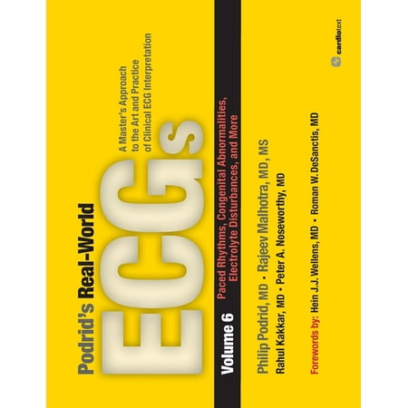 UPC: 9781935395065 | Podrid s Real-World ECGs: Volume 6  Paced Rhythms  Congenital Abnormalities  Electrolyte Disturbances  and More: A Master s Approach to the Art and Practice of Clinical ECG Interpretation. (Paperback)