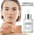 thumbnail image 2 of Essences Face Centella Asiatica Serum, alivia y repara la piel sensible, apto para todo tipo de pieles, 30 ml en liquidación, 2 of 6
