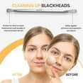 thumbnail image 2 of Professional Blackhead and Blemish Remover - Pimple Comedone Removal 2-In-1 Extractor Tool - by Utopia Care (Square), 2 of 8