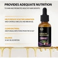 thumbnail image 4 of Fiudx Aceite Capilar de Romero, Tratamiento Nutritivo para El Cuero Cabelludo, Aceite Aromático Difusor, Suero Rejuvenecedor de La Piel, Cuidado Capilar Diario, Relajación y Bienestar, Fórmula Terapé, 4 of 6