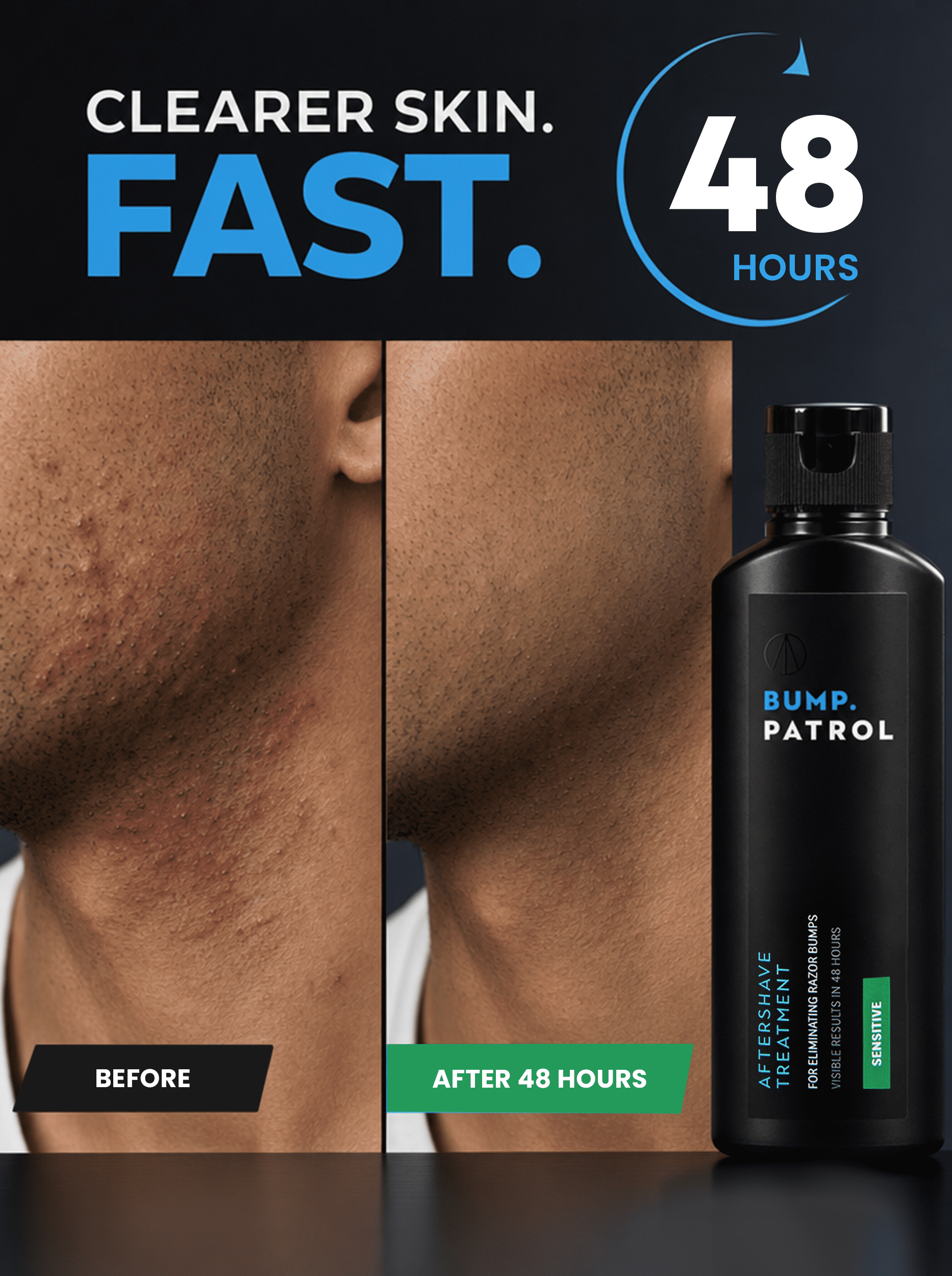 Bump Patrol Sensitive Aftershave Treatment Serum - 2 fl oz, Alcohol-free serum helps reduce razor bumps, ingrown hairs, and shaving irritation. Gentle formula for sensitive skin.