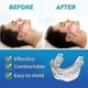 thumbnail image 4 of Snoring Stopper - Anti-Snoring Bruxism Mouth Guard, Teeth Bruxism, Sleep Apnea Guard, 4 of 4