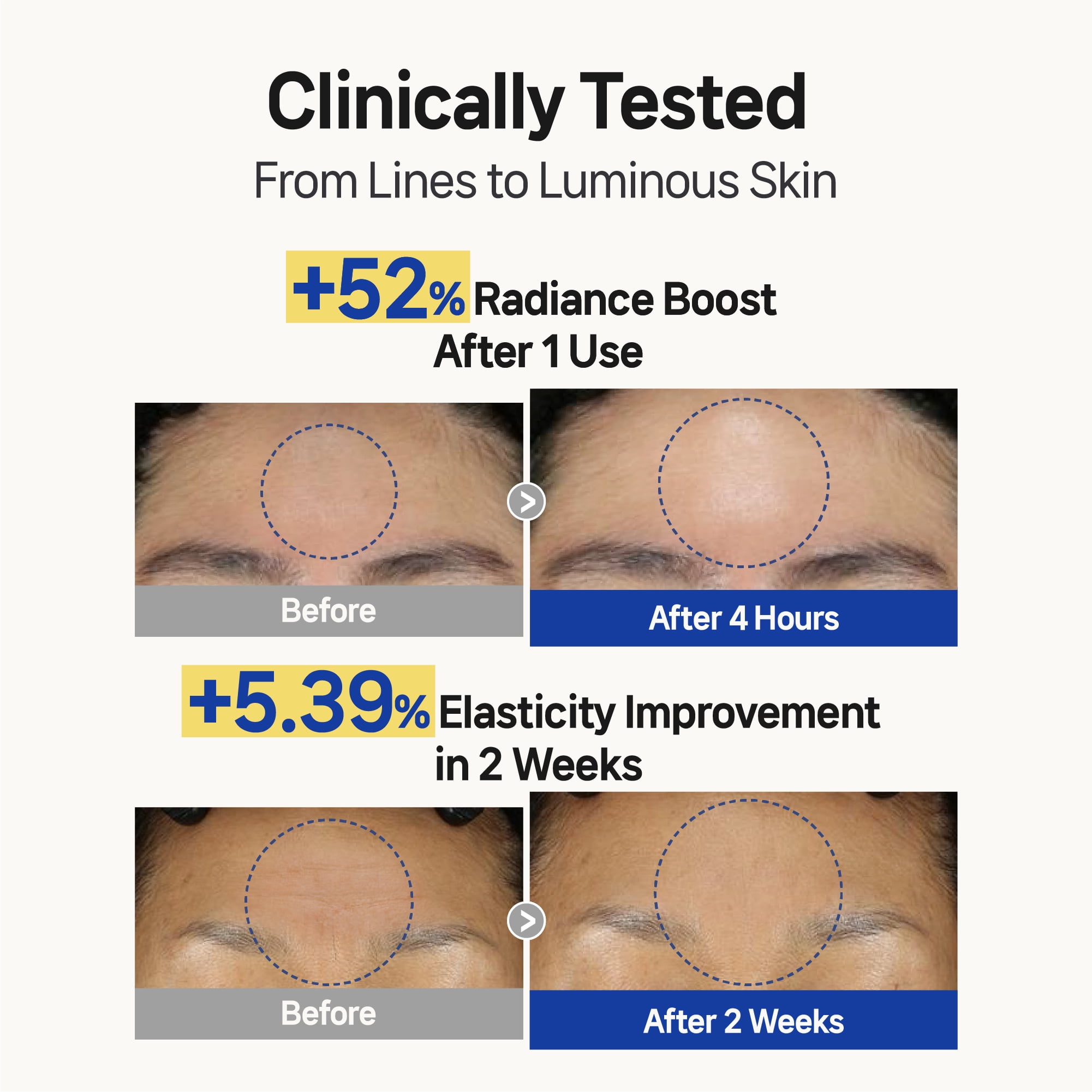 Labottach Forehead Wrinkle Patches, 12 Count
