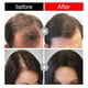 thumbnail image 3 of Ginger Hair Regrowth Shampoo Bar, Promotes Hair Growth Care Ginger Soap, 3 of 4