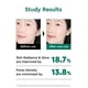 thumbnail image 5 of Gel para ojos Cocokind Peptide, ligero e hidratante, 15 ml, 5 of 5