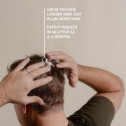 Keeps Minoxidil Solution 5% for Men - Topical Hair Regrowth - 3 Month Supply (3 x 2 fl oz Bottles)