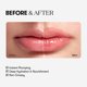 thumbnail image 4 of Lip Plumper VT COSMETICS Reedle Shot Ácido hialurónico 4,3 g, 4 of 8