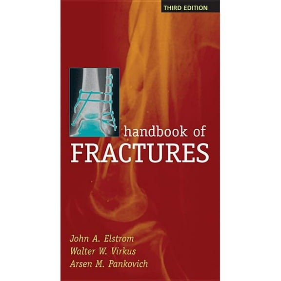 Handbook of Fractures, Third Edition, (Paperback)