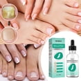 thumbnail image 1 of 30ML 1FL OZ Toenail Fix Liquid To Fix Nails, Rotten Toenails, Mild Toenails, Mild Toenails,Bright Nails,, 1 of 5