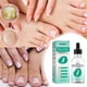 thumbnail image 2 of Maojin 30ML 1FL OZ líquido para arreglar uñas de los pies para arreglar uñas,uñas de los pies podridas,uñas de los pies suaves,uñas de los pies suaves,uñas brillantes,, 2 of 6