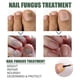 thumbnail image 4 of 50ml Nail Fungus Treatment Solution Extracts Remove Onychomycosis No Yellowing Restore Shine Nail Repair Care, 4 of 5
