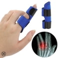 thumbnail image 3 of Luxtrada Adjustable Pain Relief Trigger Finger Fixing Splint Straightening Brace Corrector Support, Finger Support,Finger Splint, 3 of 12