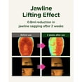 thumbnail image 4 of Serum CKD Retino Collagen Guasha Rellenado Facial Lifting de 40 ml, 4 of 8