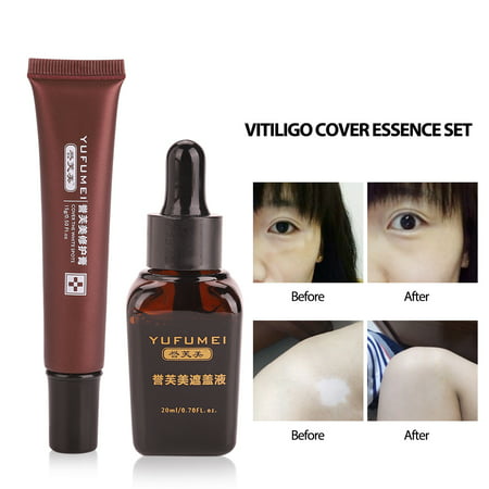 WALFRONT Professional Waterproof Tattoo Scar Concealer, Hiding Spots Birthmarks Repair Cream Vitiligo Cover Liquid Set