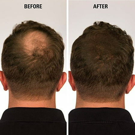 Eclipse Hair Building Fibers Beard Filler Instant Hair Fillers
