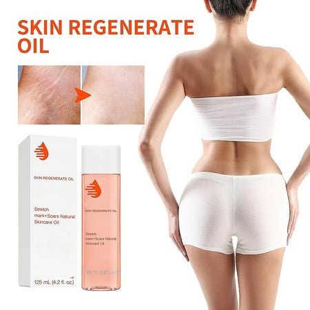 Collagen Boost Firming & Lifting Skincare Oil, Stretch Marks Remover Essential Oil, Skin Care Treatment Cream For Stretch Mark