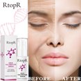 thumbnail image 4 of RtopR Essence de Polypeptide d'Or Hydratant Visage Hydratant Réparation Raffermissant Peau 20ml, 4 of 5