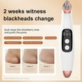 thumbnail image 4 of Blackhead Remover Pore Vacuum, Visible Facial Pore Ceaner, Skin Care Tool for Acne Pimples with Magnification, Blackhead Extractor, Used for Extraction of Acne and Blackhead, 4 of 5