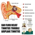 thumbnail image 4 of SOUTH MOON 20ml Ear Ringing Relieving Ear Drops Tinnitus Deafness Ear Swelling Ear Disc, 4 of 5