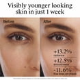 thumbnail image 5 of Neutrogena Rapid Wrinkle Repair Retinol Night Cream, 1 fl. oz, 5 of 12